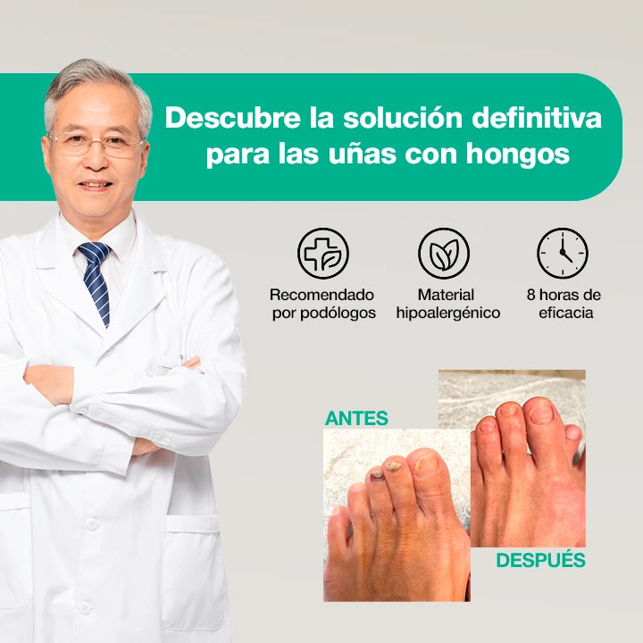 NutriNail® – El único adhesivo antifúngico que elimina los hongos al instante