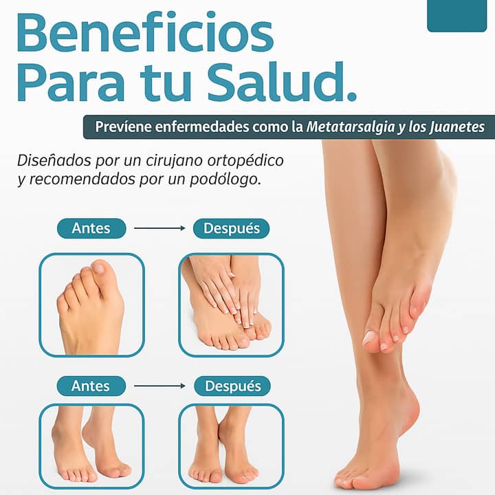 Almohadillas terapéuticas con Separador de dedos - Comfortfy™