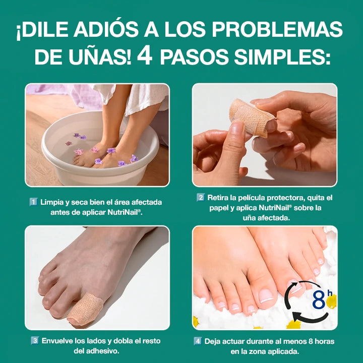 NutriNail® – El único adhesivo antifúngico que elimina los hongos al instante