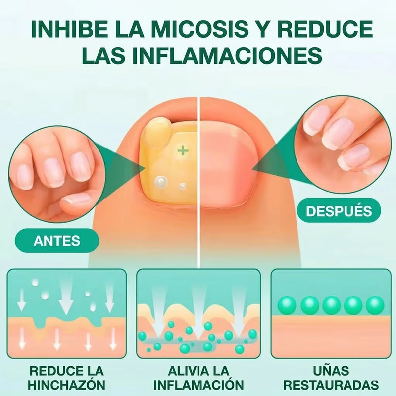 Mejora el aspecto de uñas dañadas mientras duermes — sin cremas ni tratamientos agresivos